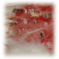 Loncologie les parasites de la personne
